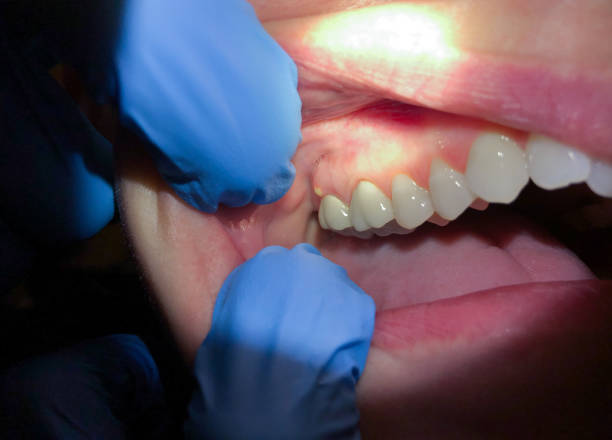 Best Urgent Care for Lost Fillings or Crowns in Minnetonka, MN